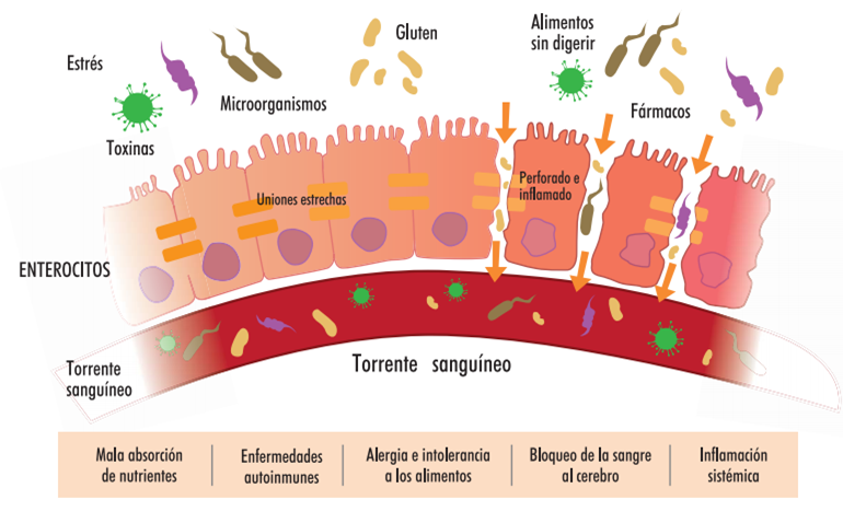 Alimentos que se pueden comer con el intestino inflamado